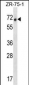RCOR1 Antibody (N-term)